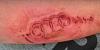 Deploying airbag literally brands man as an Audi driver-37e2302d95a1912e4d2240e48bca9c.jpg